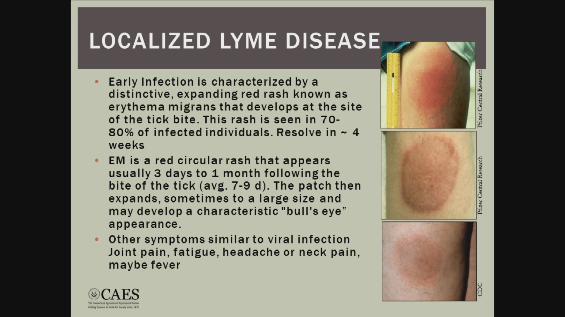 Thumbnail image for Healthy Town Episode 24:  Ticks: It's More Than Just Lyme Disease